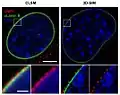 Comparison confocal microscopy&nbsp;– 3D-SIM