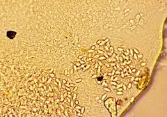 Cnidocysts