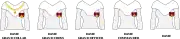 Order of wear of insignia for women at each grade.